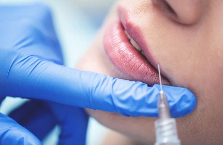 kwas hialuronowy wstrzykiwany w&nbsp;usta