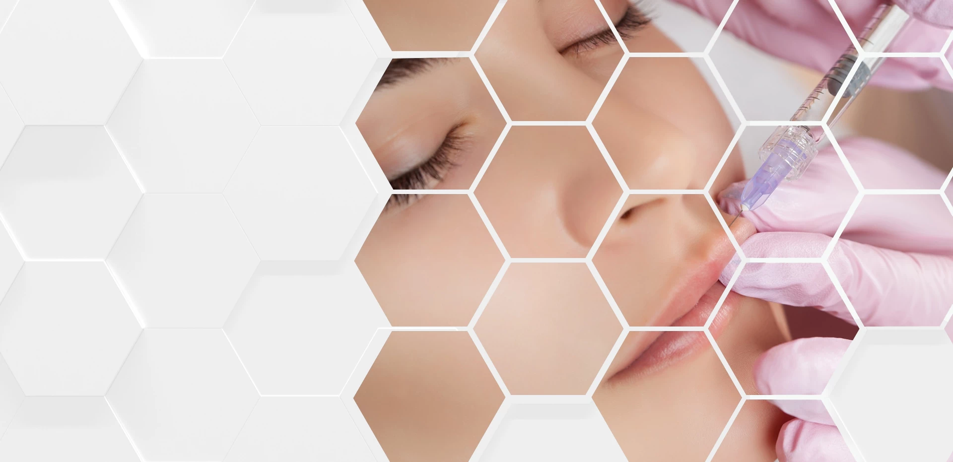 zabieg powiększania ust